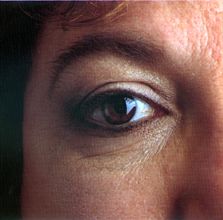 eye.nat.eye.institute